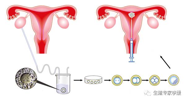 济南齐鲁不孕不育