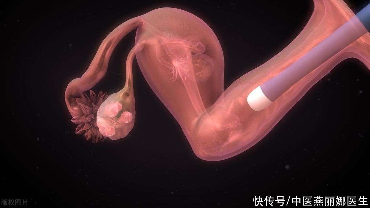 试管婴儿